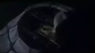 شرج مفتوح متطرف وحفلة نزول سوائل