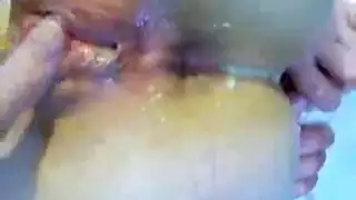 سكسح