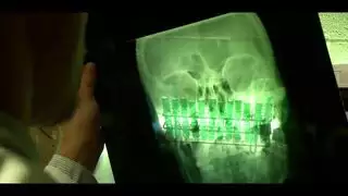أول اختراق مزدوج للزوجين الفرنسيين: جنس شرجي ومهبلي قاسي