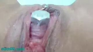 سكس دكتور فحص طيز